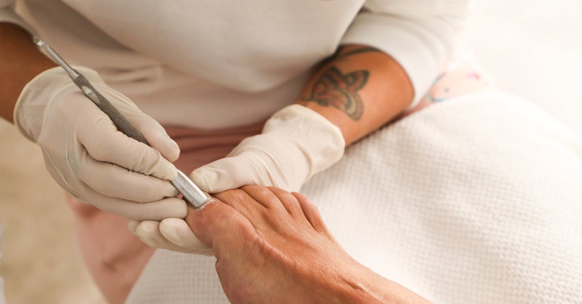 A Comprehensive Guide to Ankle Arthroscopy