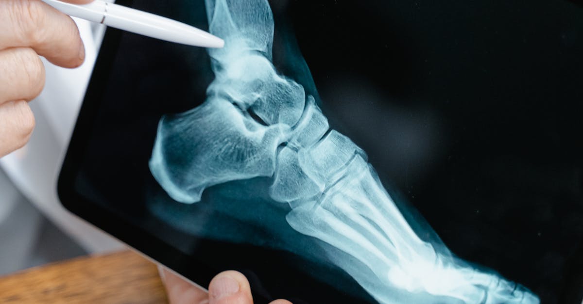 Post-Surgical Care: A Guide to Nail Surgery Recovery