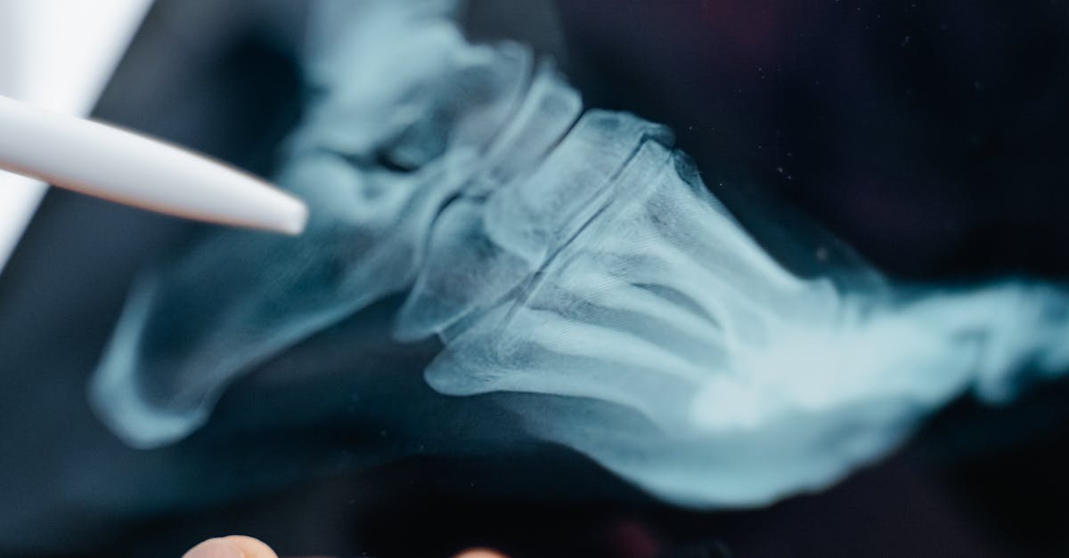 The Connection Between Flat Feet and Postural Issues