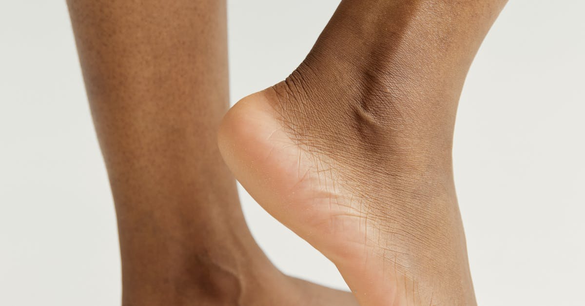The Connection Between Foot Structure and Sports Injuries