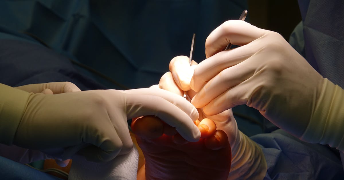 Understanding the Impact of Diabetes on Foot Health